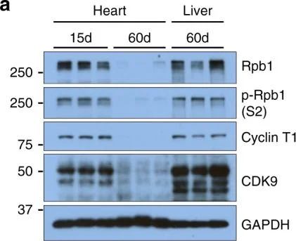 Western blot - Anti-Cyclin T1 antibody [EPR17982] - BSA and Azide free (AB238940)