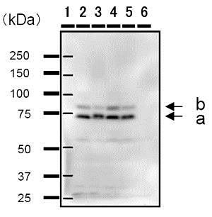 Western blot - Anti-Cyclin T2/CCNT2 antibody [2128C1a] (AB50979)