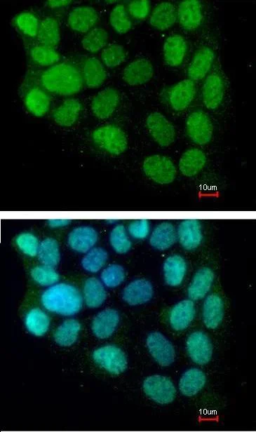 Immunocytochemistry/ Immunofluorescence - Anti-Cyclin T2/CCNT2 antibody (AB96133)