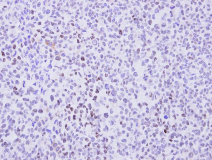 Immunohistochemistry (Formalin/PFA-fixed paraffin-embedded sections) - Anti-Cyclin T2/CCNT2 antibody (AB96133), expandable thumbnail