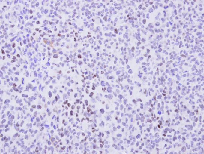 Immunohistochemistry (Formalin/PFA-fixed paraffin-embedded sections) - Anti-Cyclin T2/CCNT2 antibody (AB96133)