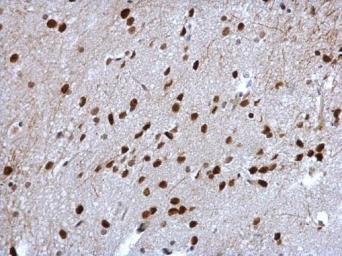 Immunohistochemistry (Formalin/PFA-fixed paraffin-embedded sections) - Anti-Cyclin T2/CCNT2 antibody (AB96133), expandable thumbnail