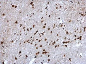 Immunohistochemistry (Formalin/PFA-fixed paraffin-embedded sections) - Anti-Cyclin T2/CCNT2 antibody (AB96133)
