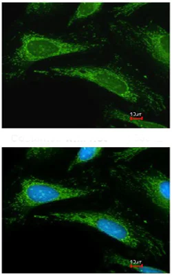 Immunocytochemistry/ Immunofluorescence - Anti-Cyclophilin A antibody (AB137684)