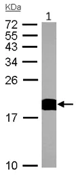 Western blot - Anti-Cyclophilin A antibody (AB137684)