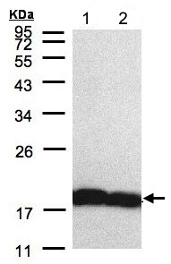 Western blot - Anti-Cyclophilin A antibody (AB137684), expandable thumbnail