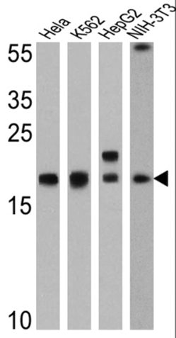 Western blot - Anti-Cyclophilin A antibody (AB3563)