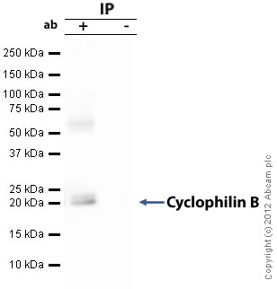 Immunoprecipitation - Anti-Cyclophilin B antibody (AB16045), expandable thumbnail