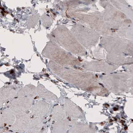Immunohistochemistry (Formalin/PFA-fixed paraffin-embedded sections) - Anti-Cyclophilin B antibody [CL3901] - Loading Control (ab236760), expandable thumbnail