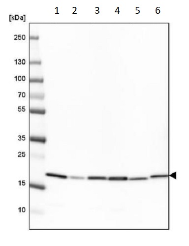 Western blot - Anti-Cyclophilin B antibody [CL3901] - Loading Control (AB236760), expandable thumbnail