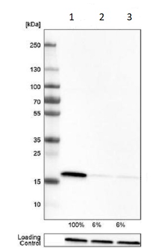 Western blot - Anti-Cyclophilin B antibody [CL3901] - Loading Control (AB236760), expandable thumbnail