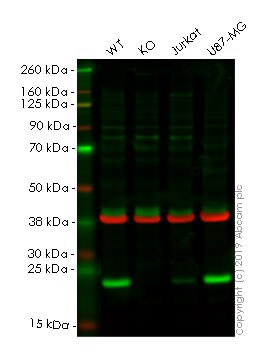 Western blot - Anti-Cyclophilin B antibody [EPR12703(B)] - BSA and Azide free (AB238991), expandable thumbnail