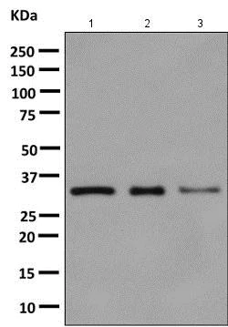 Western blot - Anti-Cyclophilin E antibody [EPR10805(B)] - BSA and Azide free (AB249164)