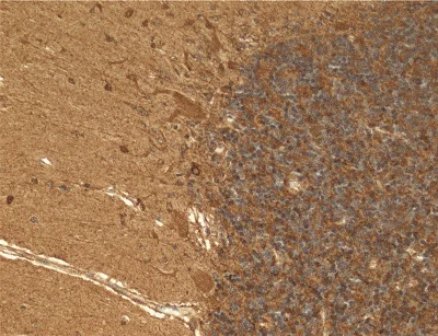 Immunohistochemistry (Formalin/PFA-fixed paraffin-embedded sections) - Anti-Cyclophilin F antibody [E11AE12BD4] (AB110324)
