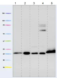 Western blot - Anti-Cyclophilin F antibody [E11AE12BD4] (AB110324)