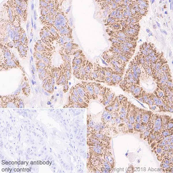 Immunohistochemistry (Formalin/PFA-fixed paraffin-embedded sections) - Anti-Cyclophilin F antibody [EPR11311-121] (AB231155)