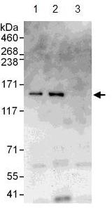 Immunoprecipitation - Anti-CYFIP1 antibody (AB108220)