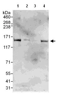 Western blot - Anti-CYFIP1 antibody (AB108220)