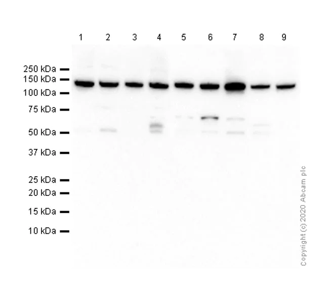 Western blot - Anti-CYFIP1 antibody [EPR10782] (AB156016)