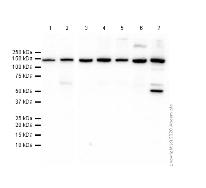 Western blot - Anti-CYFIP1 antibody [EPR10782] (AB156016)