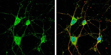 Immunocytochemistry/ Immunofluorescence - Anti-CYFIP1 antibody - N-terminal (AB154045)