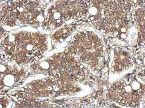Immunohistochemistry (Formalin/PFA-fixed paraffin-embedded sections) - Anti-CYFIP1 antibody - N-terminal (AB154045)