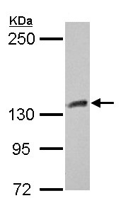 Western blot - Anti-CYFIP1 antibody - N-terminal (AB154045)