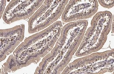 Immunohistochemistry (Formalin/PFA-fixed paraffin-embedded sections) - Anti-CYFIP2 antibody (AB95969)