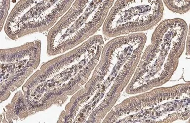 Immunohistochemistry (Formalin/PFA-fixed paraffin-embedded sections) - Anti-CYFIP2 antibody (AB95969)