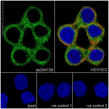 Immunocytochemistry/ Immunofluorescence - Anti-CYFIP2 + CYFIP1 antibody [EPR17848-87] (ab204129), expandable thumbnail