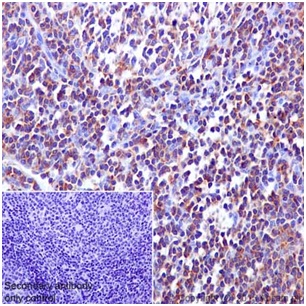 Immunohistochemistry (Formalin/PFA-fixed paraffin-embedded sections) - Anti-CYFIP2 + CYFIP1 antibody [EPR17848-87] (AB204129), expandable thumbnail