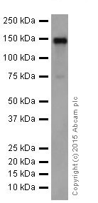 Western blot - Anti-CYFIP2 + CYFIP1 antibody [EPR17848-87] (AB204129), expandable thumbnail