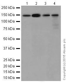 Western blot - Anti-CYFIP2 + CYFIP1 antibody [EPR17848-87] (AB204129)