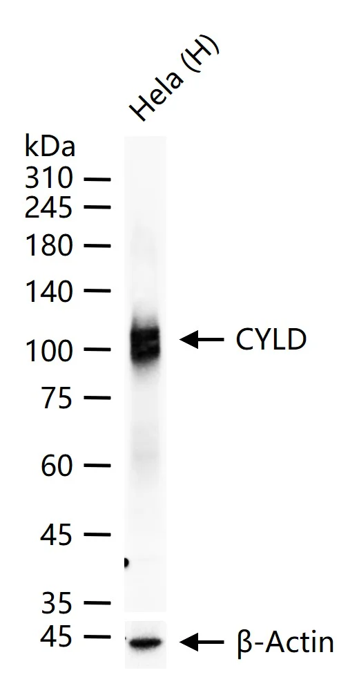 Western blot - Anti-CYLD antibody [5C7] (AB326707)