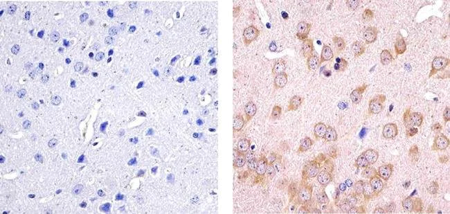 Immunohistochemistry (Formalin/PFA-fixed paraffin-embedded sections) - Anti-CYLD antibody [733] - N-terminal (AB200476)