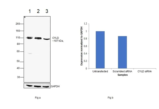 Western blot - Anti-CYLD antibody [733] - N-terminal (AB200476)