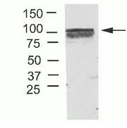 Western blot - Anti-CYLD antibody [733] - N-terminal (AB200476)