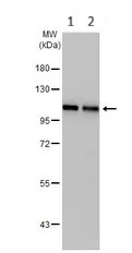 Western blot - Anti-CYLD antibody (AB137524)