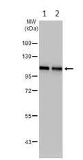 Western blot - Anti-CYLD antibody (AB137524)