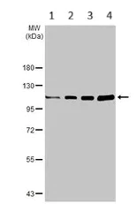 Western blot - Anti-CYLD antibody (AB137524)