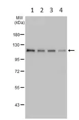 Western blot - Anti-CYLD antibody (AB137524)