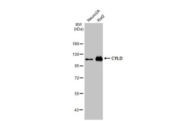 Western blot - Anti-CYLD antibody [HL1260] - BSA and Azide free (AB313838), expandable thumbnail
