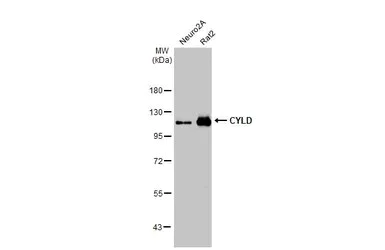 Western blot - Anti-CYLD antibody [HL1260] - BSA and Azide free (AB313838)