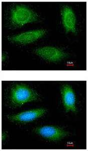 Immunocytochemistry/ Immunofluorescence - Anti-CYLD antibody - N-terminal (AB153698), expandable thumbnail