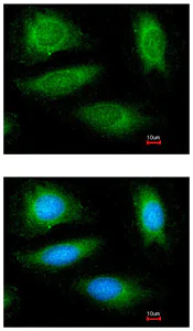 Immunocytochemistry/ Immunofluorescence - Anti-CYLD antibody - N-terminal (AB153698)