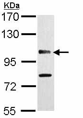 Western blot - Anti-CYLD antibody - N-terminal (AB153698), expandable thumbnail