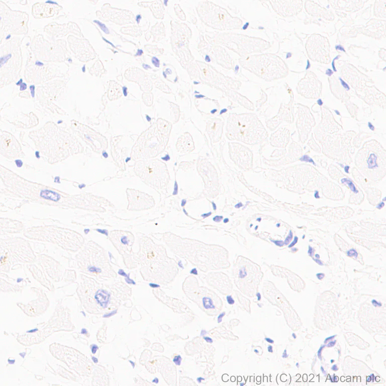 Immunohistochemistry (Formalin/PFA-fixed paraffin-embedded sections) - Anti-CYP11A1 antibody [EPR24868-86] - BSA and Azide free (AB288573)