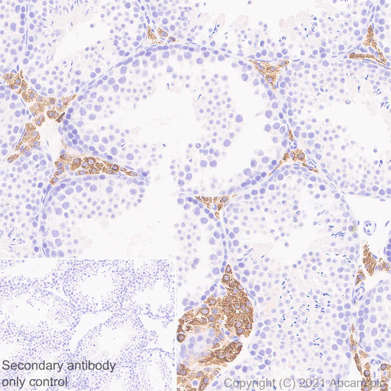 Immunohistochemistry (Formalin/PFA-fixed paraffin-embedded sections) - Anti-CYP11A1 antibody [EPR24868-86] - BSA and Azide free (AB288573)