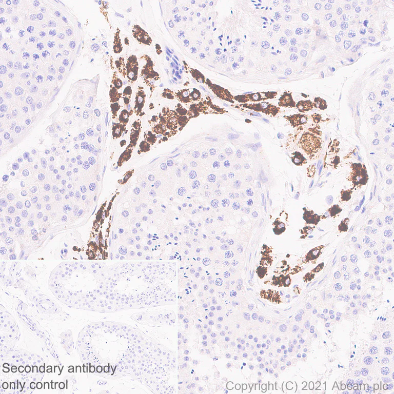 Immunohistochemistry (Formalin/PFA-fixed paraffin-embedded sections) - Anti-CYP11A1 antibody [EPR24868-86] - BSA and Azide free (AB288573)