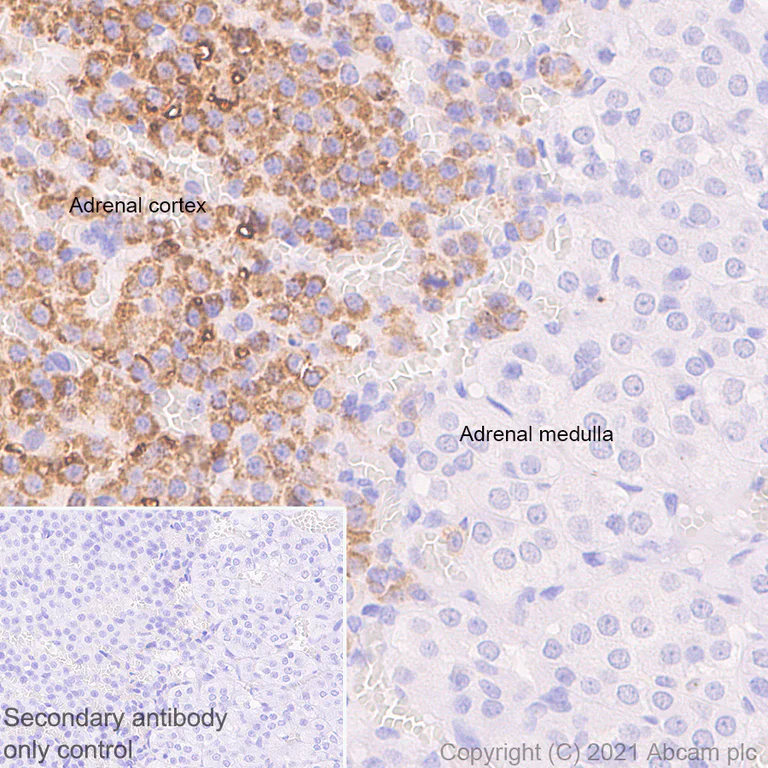 Immunohistochemistry (Formalin/PFA-fixed paraffin-embedded sections) - Anti-CYP11A1 antibody [EPR24868-86] - BSA and Azide free (AB288573)